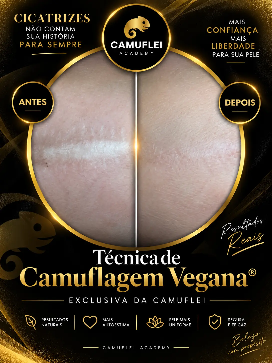 Resultado real de Camuflagem de cicatriz, comparação antes e depois