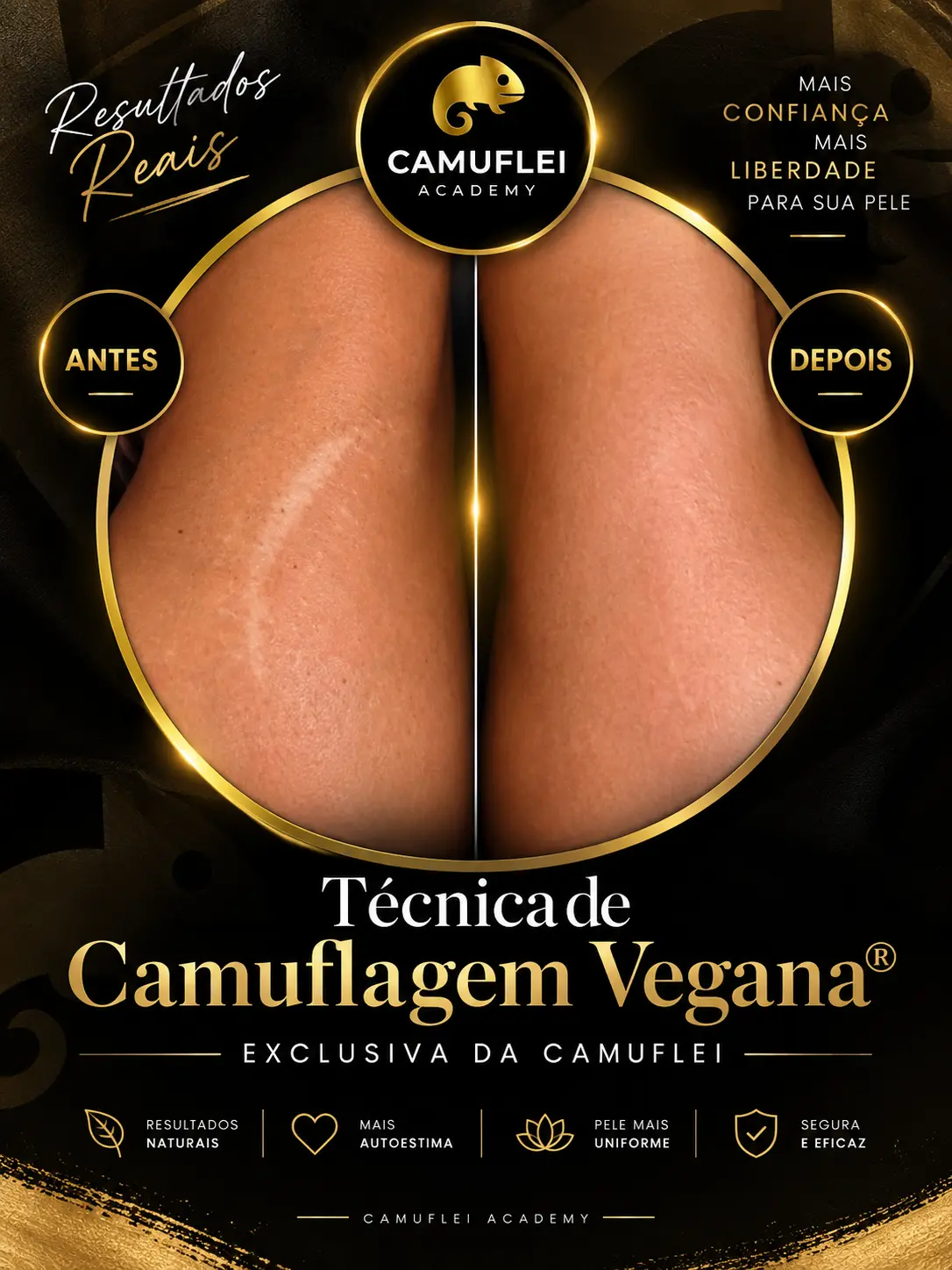 Resultado real de Camuflagem de estrias, comparação antes e depois