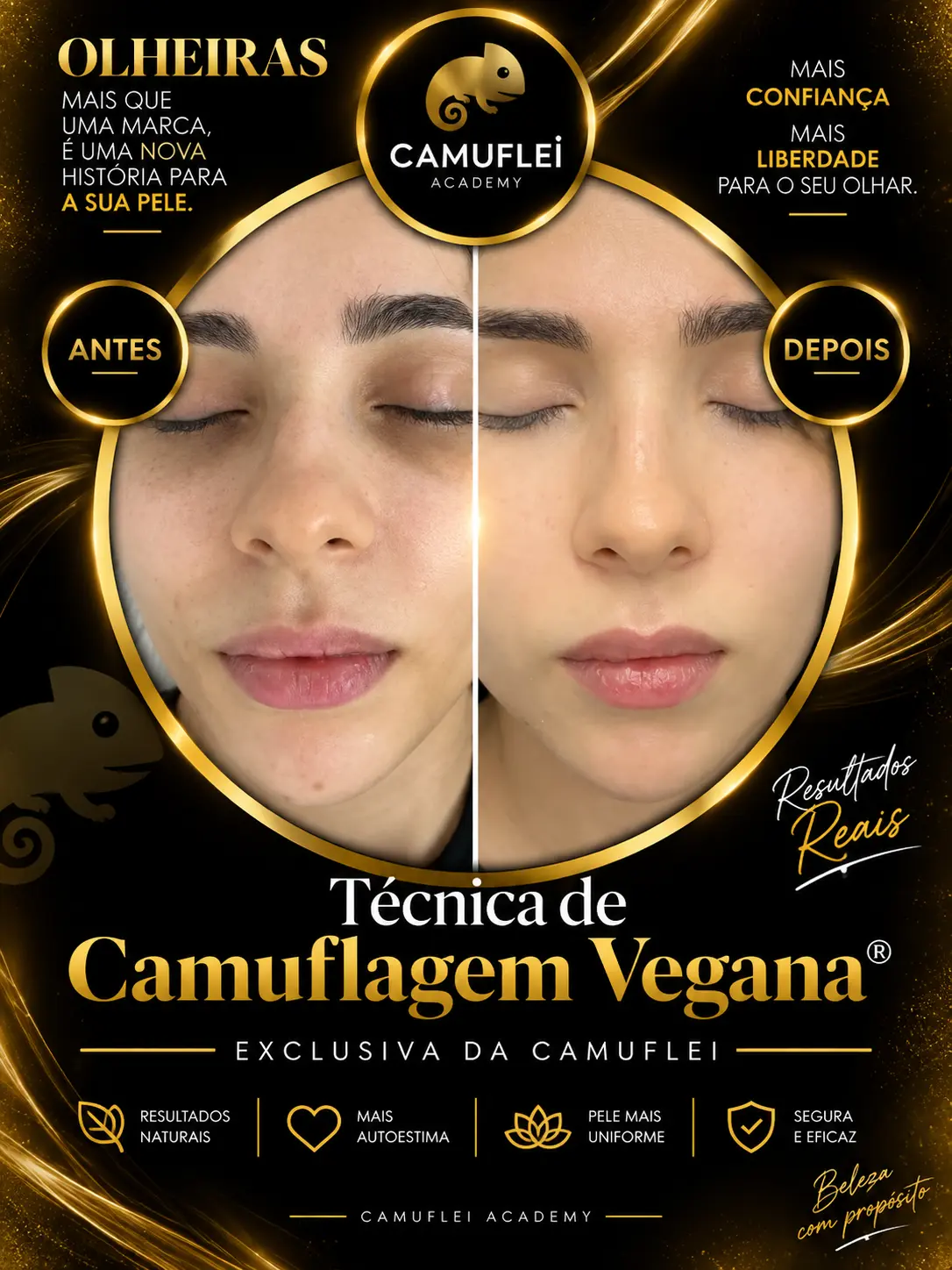 Resultado real de Camuflagem de olheiras, comparação antes e depois